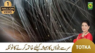 Zubaida Apa Totkay | Sar Ki Juen Khatam Karne Ka Tarika | Head Lice Removal | MasalaTv