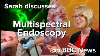 Multispectral Endoscopy for Early Detection of Oesophageal Cancer - BBC News