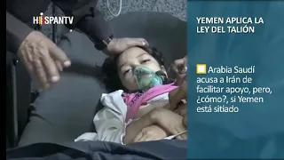 Yemen se defiende y Arabia siente los efectos de la guerra