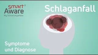 Schlaganfall: Symptome und Diagnose | Fachfortbildungen Pflege | Fortbildungen Pflege |smartAware