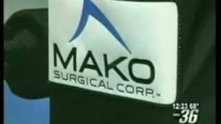 Makoplasty partial knee resurfacing for knee osteoarthritis