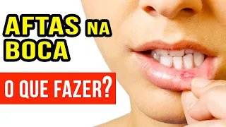 AFTAS NA BOCA? O que FAZER e O que pode ser?