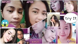 BELLA SKIN FEEDBACK | WALANG AWW PERO WOW | BEFORE & AFTER PHOTOS