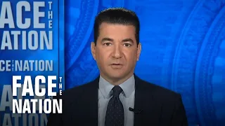 Gottlieb says U.S. likely "much further in this epidemic than we're picking up