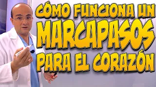 ¿CÓMO FUNCIONA un MARCAPASOS para el CORAZÓN?