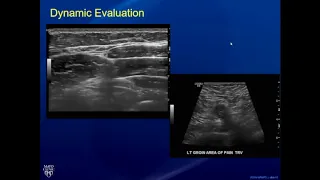 Ultrasound of Lumps and Bumps