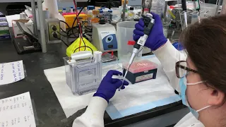 SDS PAGE and Western Blot