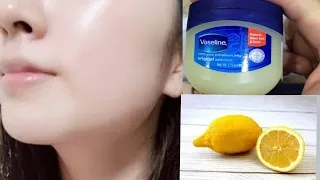 🔥How to apply vaseline and lemon on face | Apply vaseline on your skin and see the magic #trending