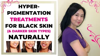 Hyperpigmentation Treatments for Black Skin and Darker Skin Types Naturally