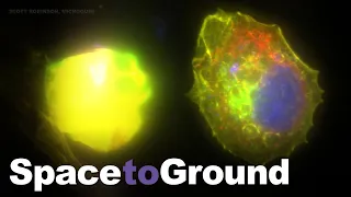 Space to Ground: Targeting Cancer Cells: 02/18/2022