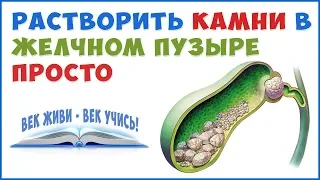 Как растворить Камни в Желчном Пузыре и Печени без операции!