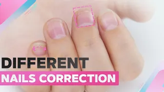 Complex Nail Correction | Different Nails | Simple French Nail Art