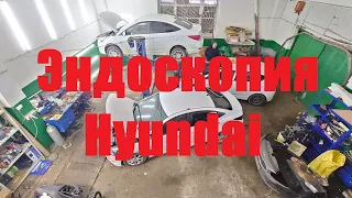 Эндоскопия двигателя Hyundai Solaris 2 , пробег 270.000км