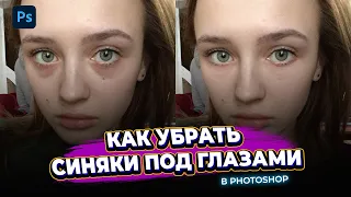 Простой способ убрать темные круги / мешки под глазами в Photoshop