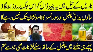 Psoriasis Ka Desi ilaj || Chambal Ka ilaj || Psoriasis Treatment At Home || Dr Sharafat Ali