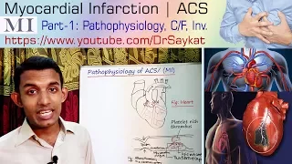 Myocardial Infarction (MI) | Part-1 | ACS | Pathophysiology | (Heart Attack) | Dr. Saykat