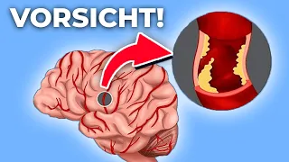 3 Lebensmittel, die du essen solltest, um einem Schlaganfall vorzubeugen!