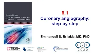 6.1 Manual of PCI - How to perform coronary angiography