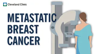 What Is Metastatic Breast Cancer?