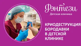 👉 Криодеструкция бородавки в детской клинике Фэнтези