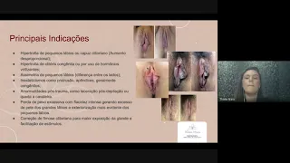 Principais Indicações de Cirurgia Íntima | Aula para Estudantes de Medicina | Dra. Thalia Maia