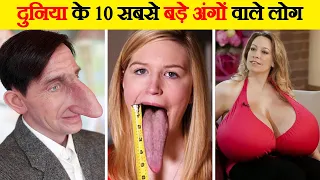 दुनिया के 10 सबसे बड़े अंगों वाले लोग | People with the Largest and Longest Body Parts in the World