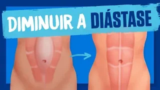 EXERCÍCIO para a DIÁSTASE abdominal! Como diminuir a diástase?