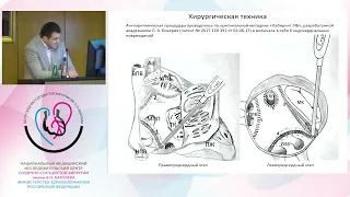 Защита диссертации Айгумов Р. Н.