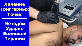 Лечение триггерных точек на УВТ. Процедура УВТ