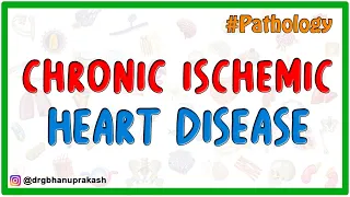 Chronic Ischemic Heart Disease - Pathology USMLE Step 1