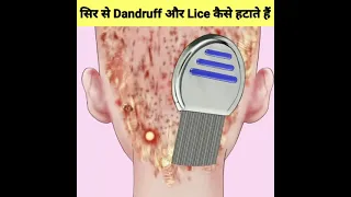 सिर से Dandruff और Lice कैसे हटाते हैं🤔–How To Remove Dandruff And Lice From Head #shorts #ytshorts