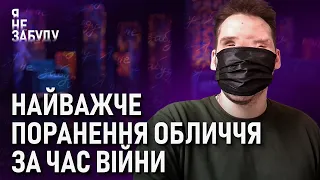 Найважче поранення обличчя за час війни | Я не забуду