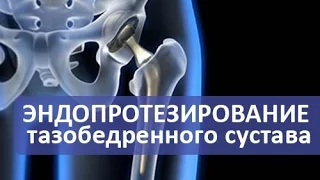 Эндопротезирование тазобедренного сустава. Операция эндопротезирования тазобедренного сустава.