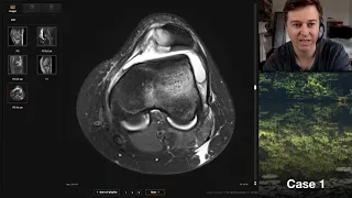 Isolation tutorial: Knee MRI with Andrew Dixon