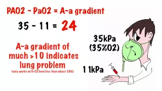 Arterial blood gas interpretation in 5 min