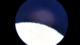 Disc rot under a microscope