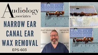 NARROW EAR CANAL EAR WAX REMOVAL - EP603