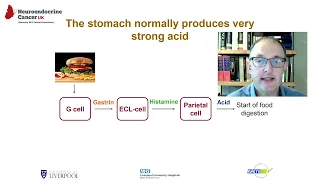 A Spotlight on Gastric Neuroendocrine Tumours