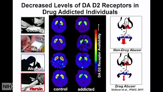 2018 Demystifying Medicine: The opioid epidemic: how, where, and what can be done?