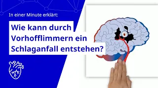 Wie kann durch Vorhofflimmern ein Schlaganfall entstehen? In einer Minute erklärt