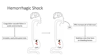 Hemorrhagic Shock