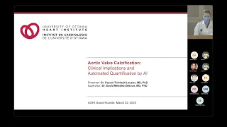 Aortic Valve Calcification: Clinical Implications and Automated Quantification by AI