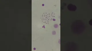 Human DNA under a microscope (magnification x1000)