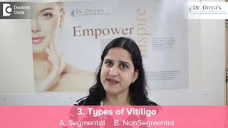 What is Vitiligo? | Dr. Divya Sharma