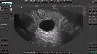 EVS and Clinical Cases