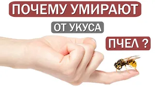 Укус насекомых / Почему умирают после укуса пчел