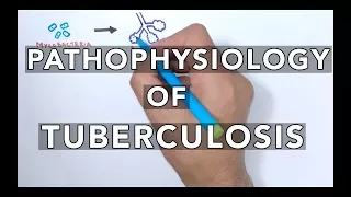 Pathophysiology of Tuberculosis