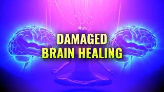 Brain Healing Frequencies: Binaural Beats for Brain Healing and Repair