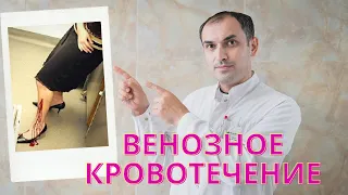 Венозное кровотечение. Остановка кровотечения. Первая помощь.