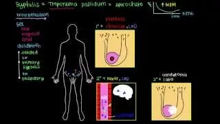 What is Syphilis?